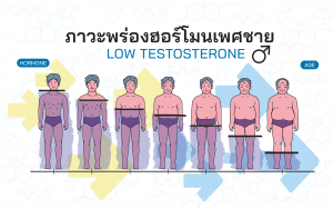 ภาวะพร่องฮอร์โมนเพศชาย